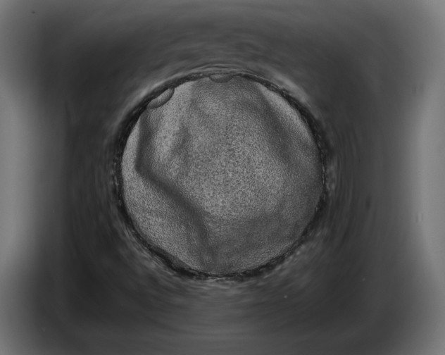 X0000086761496200705041437