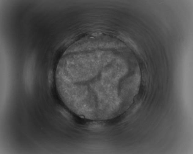 X0000086760077200705111723