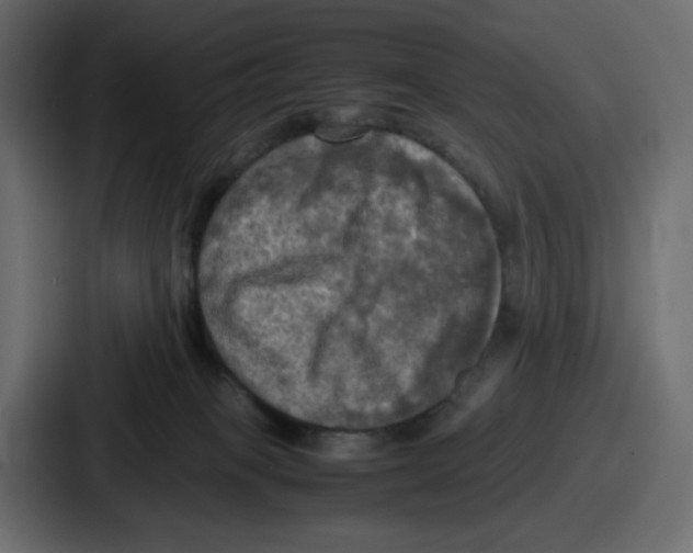 X0000086760085200705111724