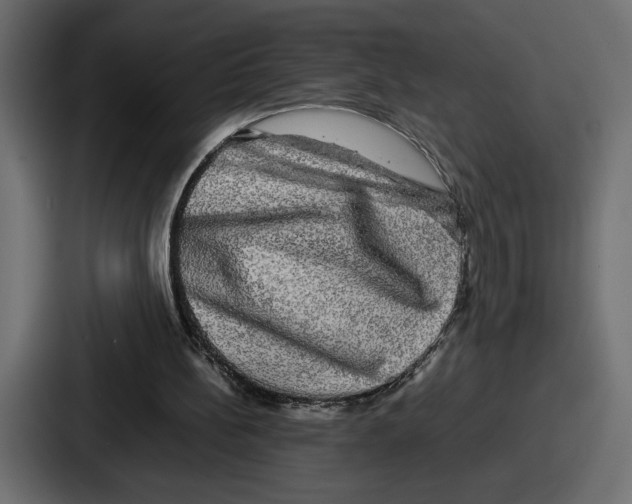 X0000086760148200705111722