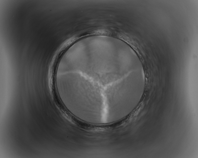 X0000086760149200705111722