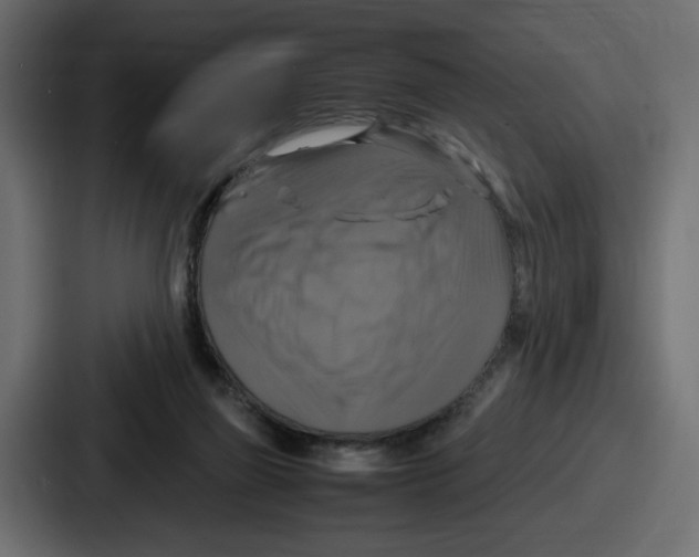 X0000086760165200705111722