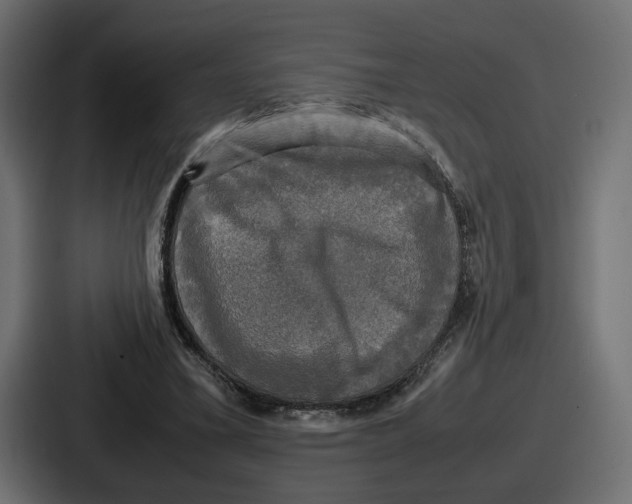 X0000086760395200705111719