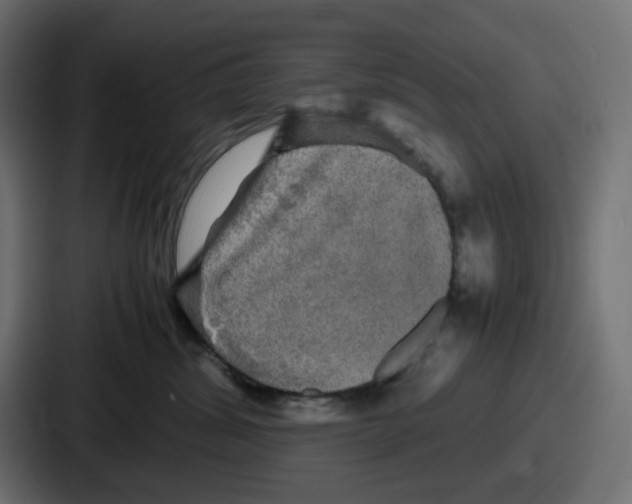 X0000086760428200705111719