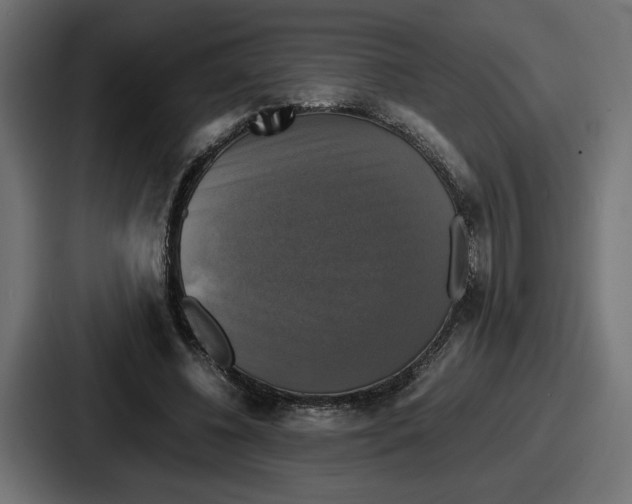 X0000086760540200705111717