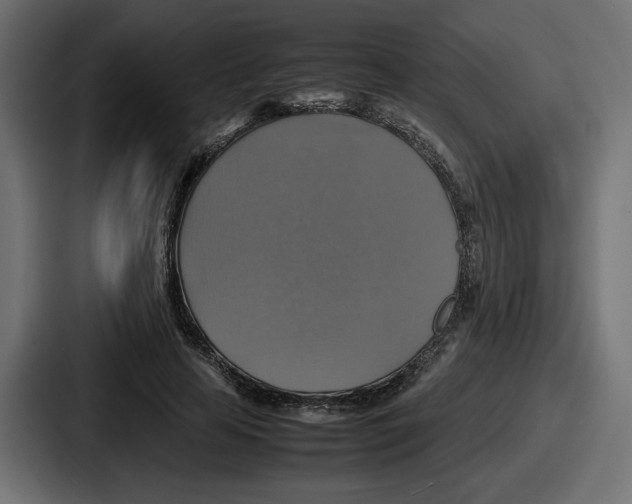 X0000086760641200705111716
