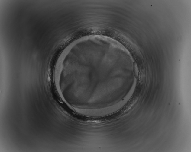 X0000086760748200705111715