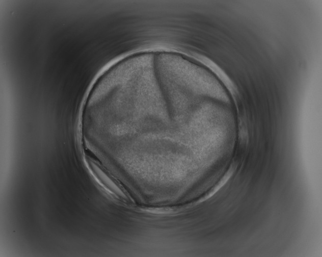 X0000086761388200705111706