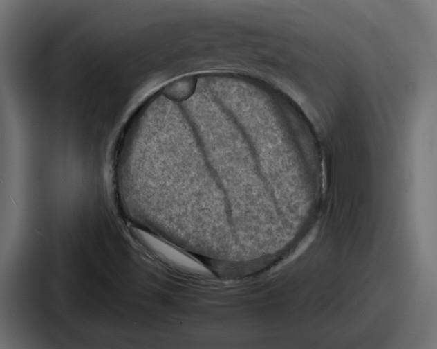 X0000086761501200705111704