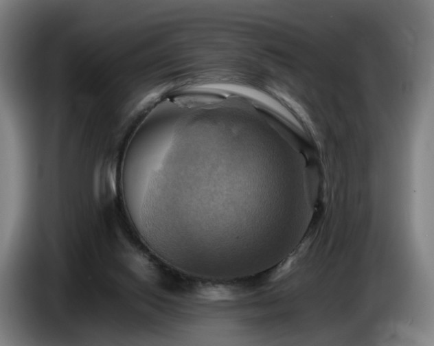 X0000086770062200704201812