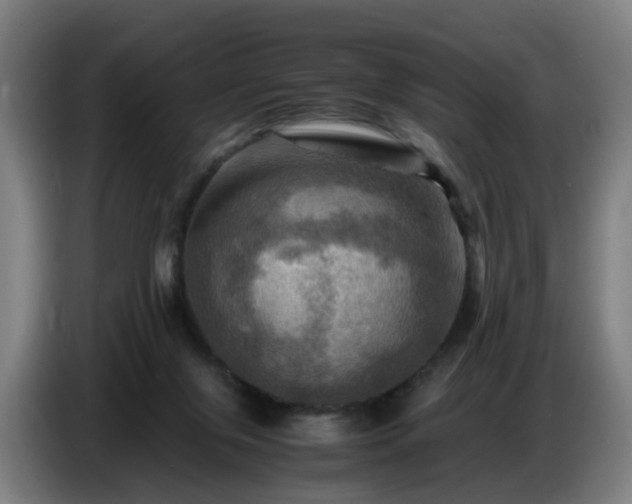 X0000086770071200704201813