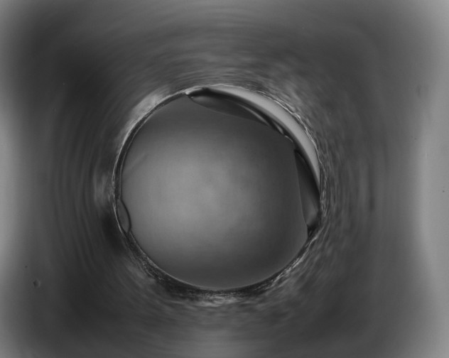 X0000086770099200704201812