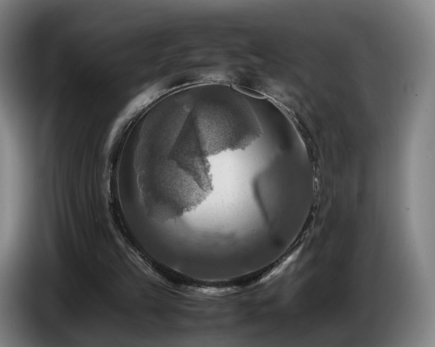 X0000086770149200704201811