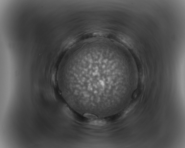 X0000086770185200704201812