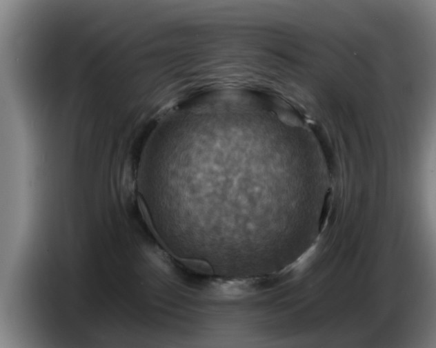 X0000086770186200704201812
