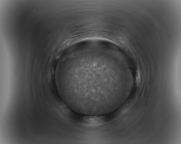 X0000086770229200704201811