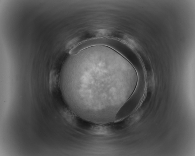X0000086770276200704201810