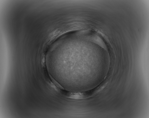 X0000086770288200704201810