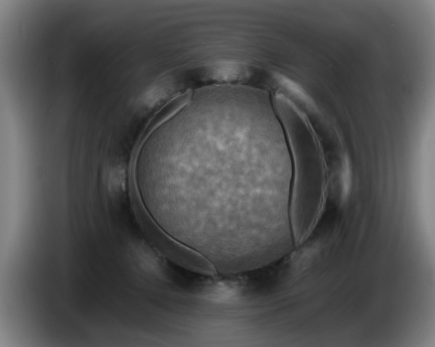 X0000086770368200704201809