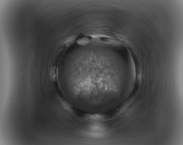 X0000086770383200704201809