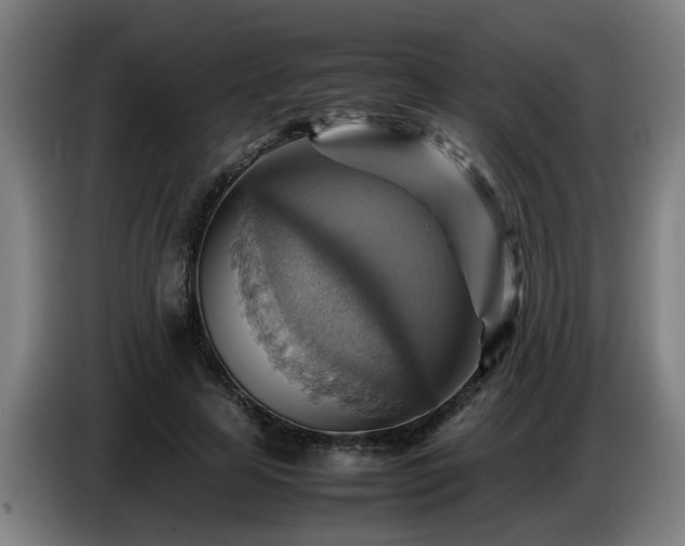 X0000086770641200704201805