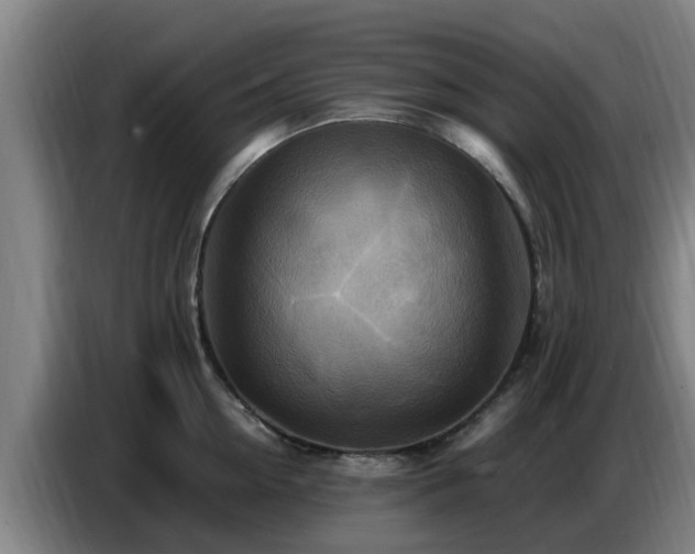 X0000086770954200704201802