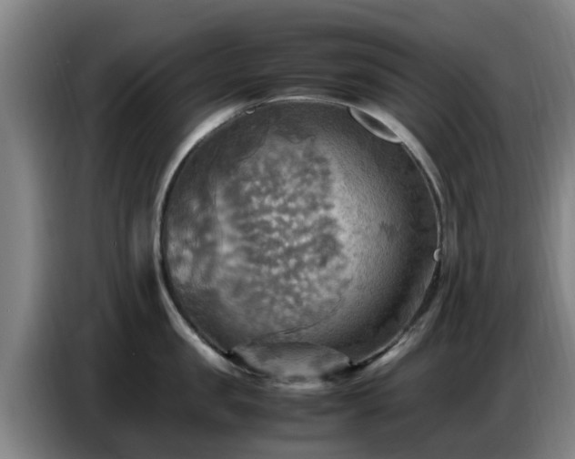 X0000086770957200704201802