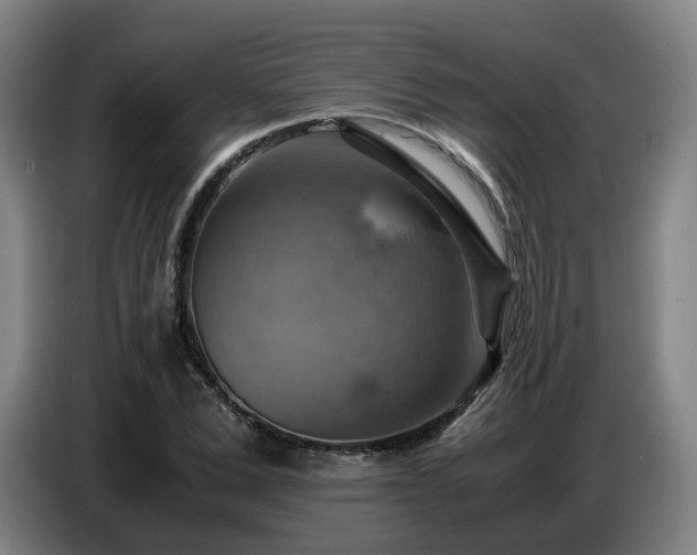 X0000086770975200704201801