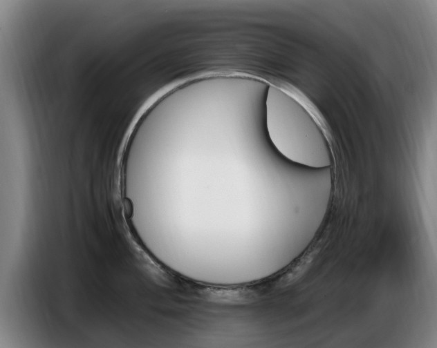X0000086771004200704201801