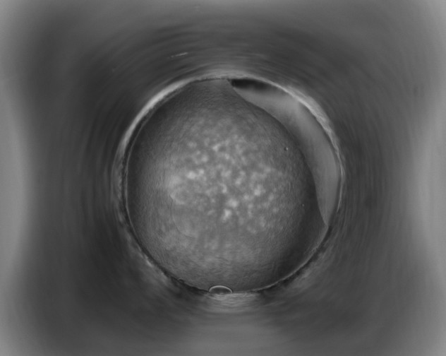 X0000086771008200704201801