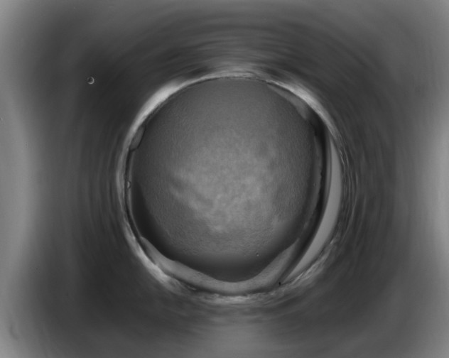 X0000086771054200704201801