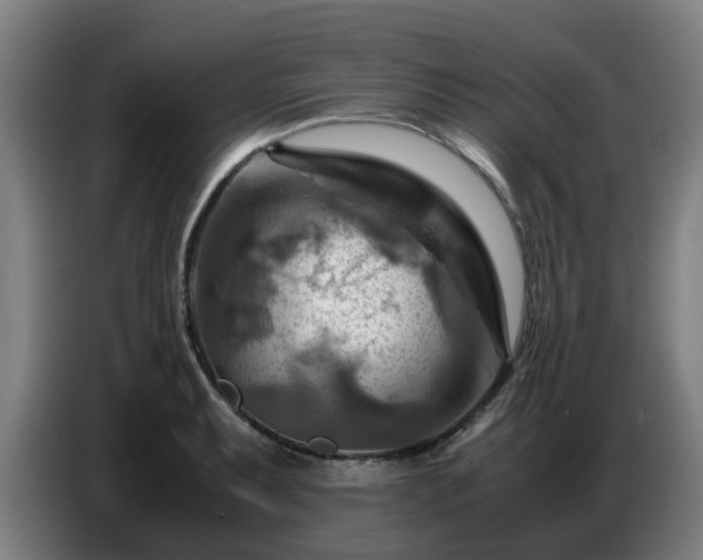 X0000086771087200704201800