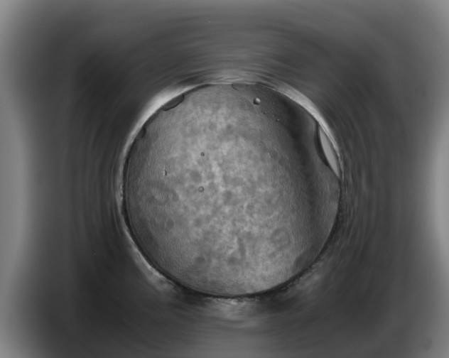 X0000086771195200704201758