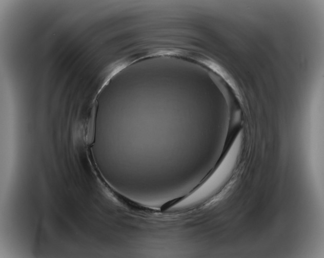 X0000086771377200704201756