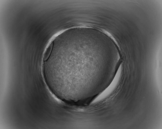 X0000086771379200704201756