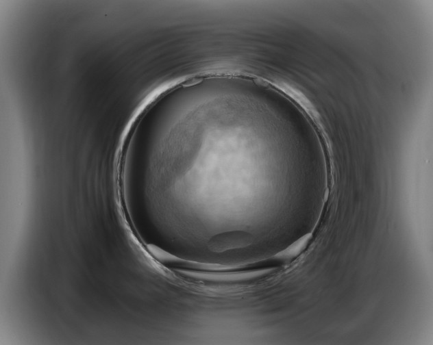 X0000086771392200704201756