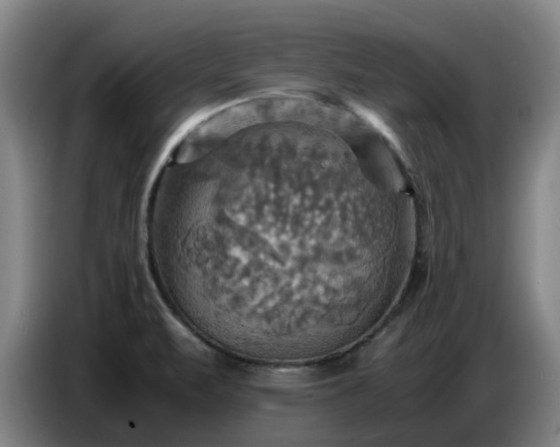 X0000086771471200704201755