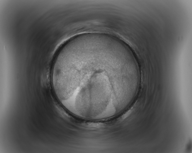 X0000086771498200704201754