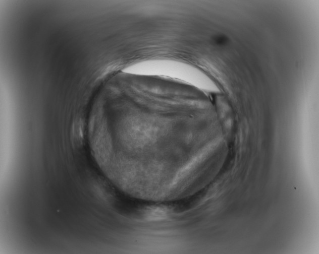 X0000086770115200704271758