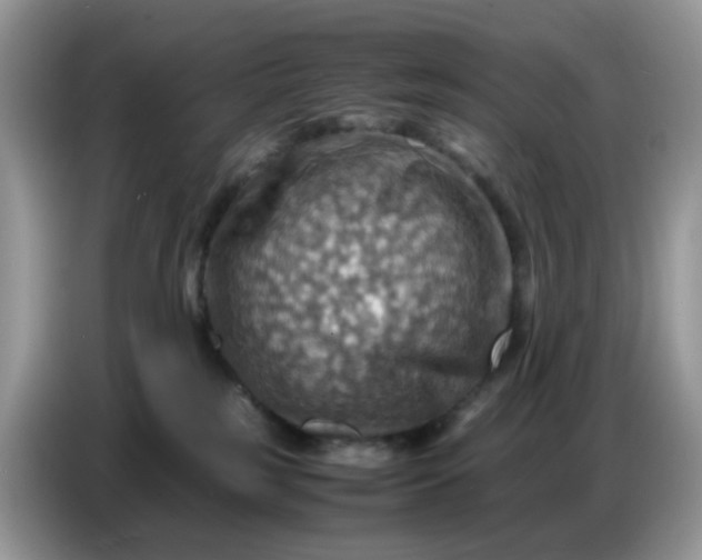 X0000086770185200704271757