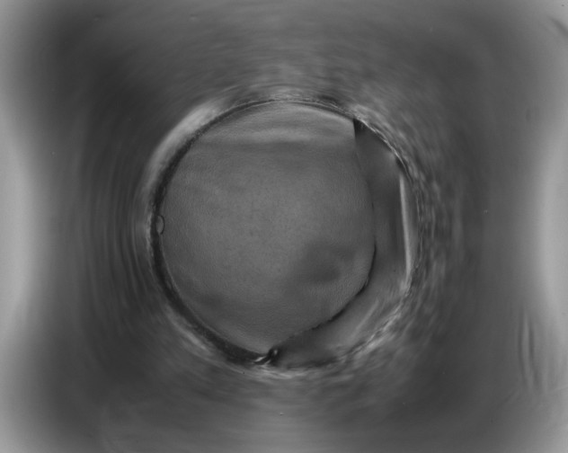 X0000086770197200704271757