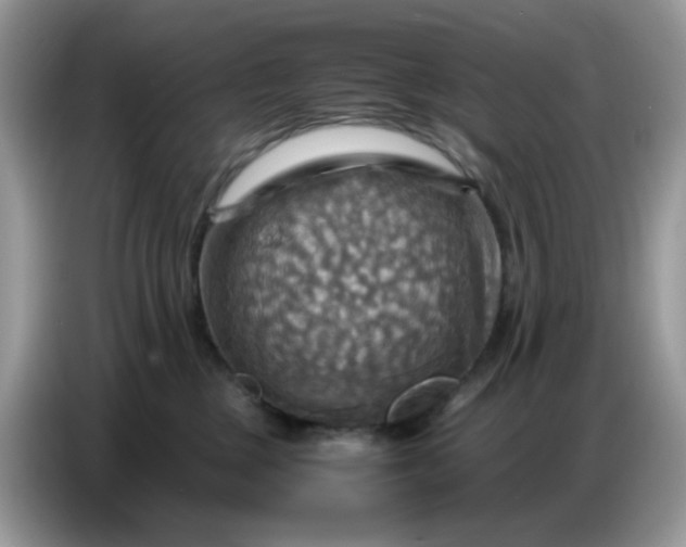 X0000086770377200704271755