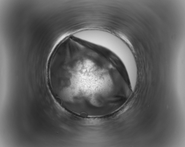 X0000086771087200704271745