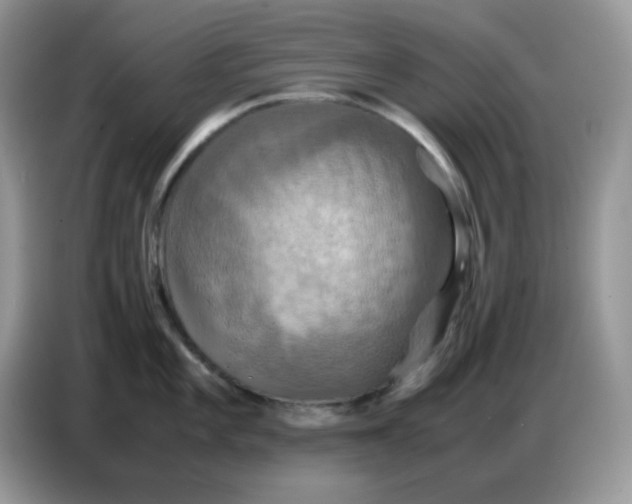 X0000086771101200704271745