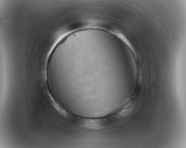 X0000086771148200704271745