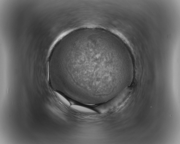 X0000086771175200704271744
