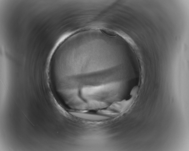 X0000086771248200704271744