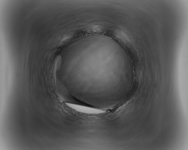 X0000086771297200704271742