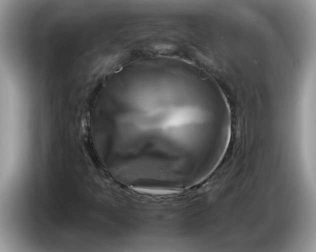 X0000086771397200704271741