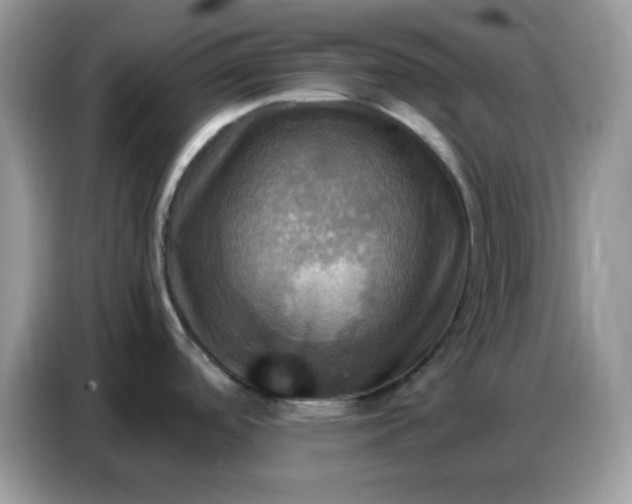 X0000086771488200704271740
